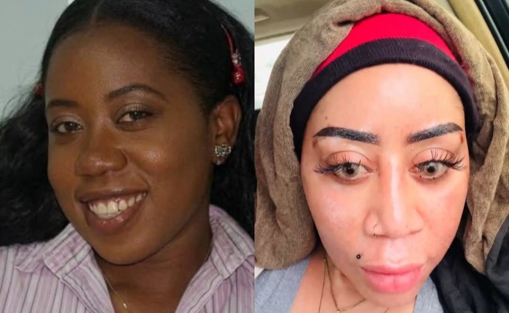 moyo-lawal-sparks-reactions-with-her-before-and-after-photographs-as-changes-impacts-her-melanin